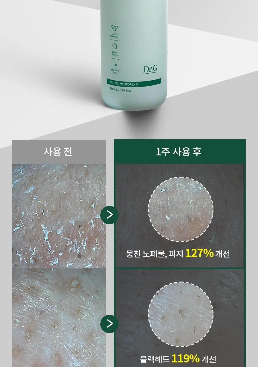 [개기름/지성] 닥터지 레드 블레미쉬 포 맨 올인원 오일컷 로션 150ml 3종 (단품/증정 기획) 상세페이지 15